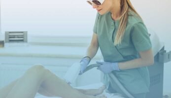 Varicose-Vein-Laser-Treatment